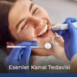 Kanal Tedavisi Nedir